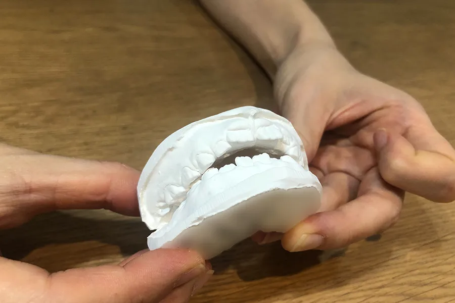 開咬の歯形 